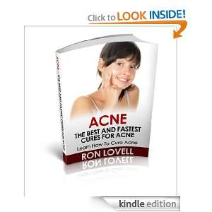 Acne   The Best and Fastest Cures for Acne Ron Lovell  