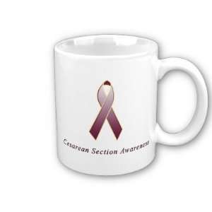 Cesarean Section Awareness Ribbon Coffee Mug