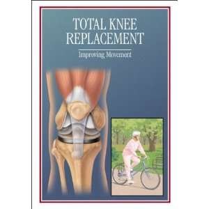 Knee Replacement, Total [ PDF] [Digital]