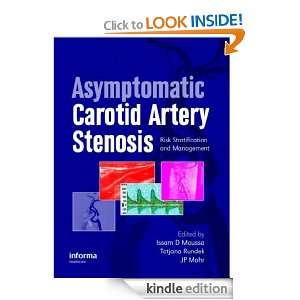 Asymptomatic Carotid Artery Stenosis A Primer on Risk Stratification 