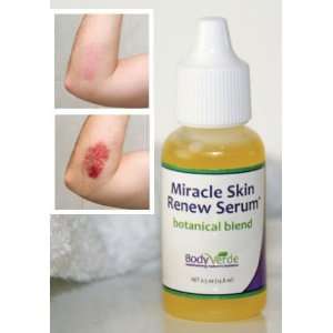  Miracle Skin Renew Serum