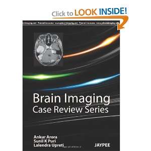 Brain Imaging (Case Review) (9789350253892) Ankur, M.D 