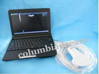   Laptop Ultrasound machine Scanner full Digital convex probe  