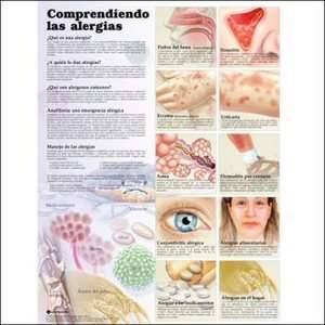 Understanding Allergies in Spanish Chart/Poster  