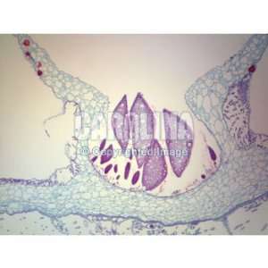 Marchantia Gemma Cup, sec. Microscope Slide, 12 u  